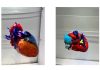 Stratasys and Ricoh Launch Clinical Study on 3D Printed Models in Orthopedic Oncology