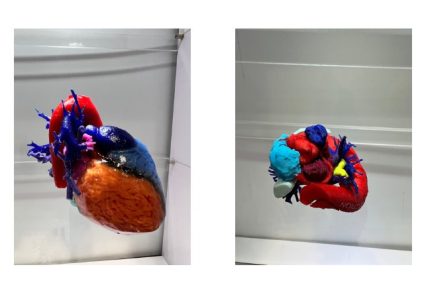 Stratasys and Ricoh Launch Clinical Study on 3D Printed Models in Orthopedic Oncology