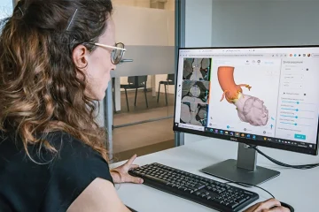 Materialise Expands Cardiovascular Capabilities through FEops Acquisition