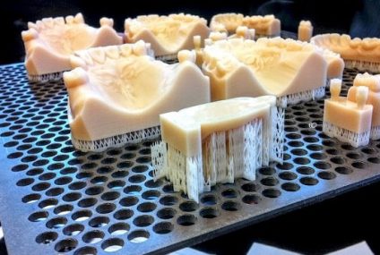 Dental 3D Printing Market Expected to Be Worth $6.5 Billion by 2025
