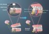 3D-Printed Piezoelectric Tooth Implant Restores Chewing Sensation in 90% of Trial Patients