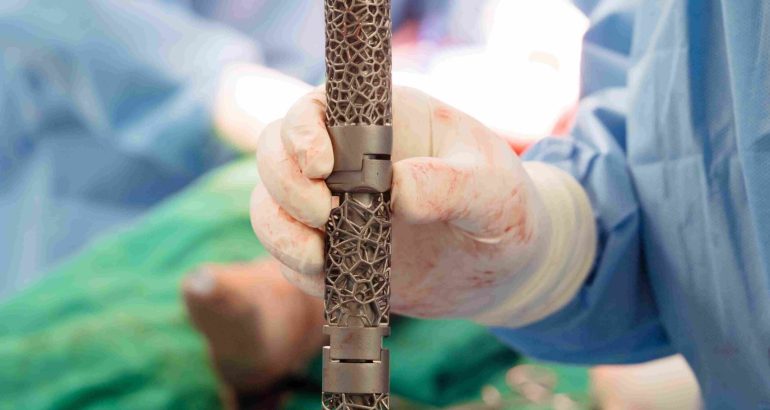 Inside Vietnam’s First Connected Surgical Ecosystem, and the Role 3D Printing Plays Within It Inside Vietnam’s First Connected Surgical Ecosystem, and the Role 3D Printing Plays Within It