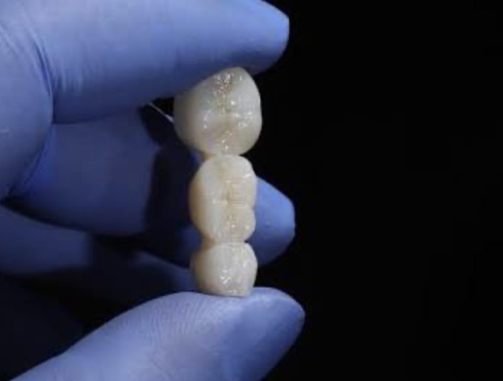 Engineers 3D Printed Permanent Zirconia Dental Crowns by Cutting a 100 Hours Process to 30 Minutes