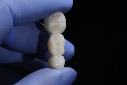 Engineers 3D Printed Permanent Zirconia Dental Crowns by Cutting a 100 Hours Process to 30 Minutes